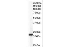 Image no. 2 for anti-Chromobox Homolog 5 (CBX5) (Internal Region) antibody (ABIN374617) (CBX5 antibody  (Internal Region))