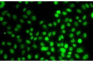 Immunofluorescence analysis of MCF-7 cells using SETD8 Polyclonal Antibody (SETD8 antibody)