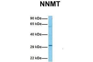 Host:  Rabbit  Target Name:  NNMT  Sample Tissue:  Human Hela  Antibody Dilution:  1.