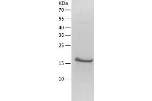 NKIRAS1 Protein (AA 1-192) (His tag)