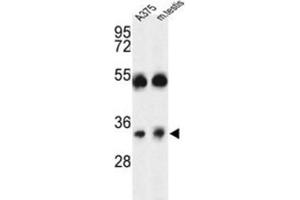 Western Blotting (WB) image for anti-ORAI Calcium Release-Activated Calcium Modulator 1 (ORAI1) antibody (ABIN3004147) (ORAI1 antibody)