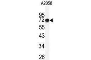 Image no. 1 for anti-FK506 Binding Protein 10, 65 KDa (FKBP10) (C-Term) antibody (ABIN453007) (FKBP10 antibody  (C-Term))