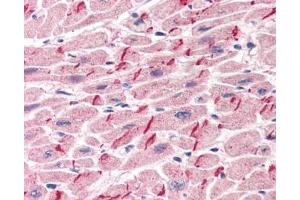 IHC testing of FFPE human heart tissue with Gamma Catenin antibody at 5ug/ml. (JUP antibody)