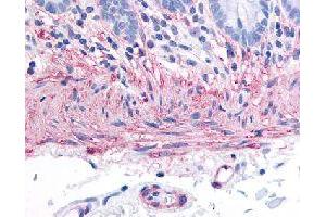 Immunohistochemical (Formalin/PFA-fixed paraffin-embedded sections) staining in human colon (smooth muscle) with TACR2 polyclonal antibody . (TACR2 antibody)