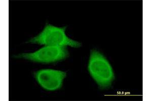 Immunofluorescence of purified MaxPab antibody to CAST on HeLa cell. (Calpastatin antibody  (AA 1-667))