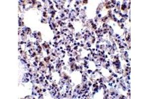 Immunohistochemistry (IHC) image for anti-B-Cell Receptor-Associated Protein 31 (BCAP31) (Middle Region) antibody (ABIN1030882) (BCAP31 antibody  (Middle Region))