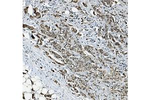 IHC analysis of RAB1B using anti-RAB1B antibody (ABIN7602809). (RAB1B antibody  (C-Term))