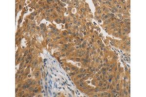 Immunohistochemistry (IHC) image for anti-Protein tyrosine Phosphatase, Non-Receptor Type 11 (PTPN11) (AA 514-593) antibody (ABIN3016707) (PTPN11 antibody  (AA 514-593))