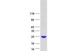 Validation with Western Blot (POP7 Protein (Myc-DYKDDDDK Tag))