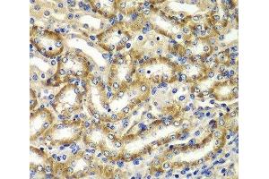 DGKE antibody