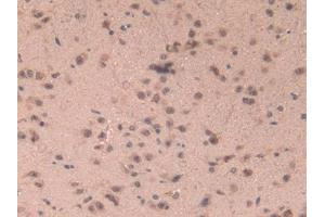IHC-P analysis of Mouse Brain Tissue, with DAB staining. (MRP1 antibody  (AA 22-116))