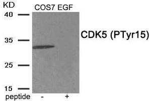 Western blot analysis of extracts from COS7 cells treated with EGF using Phospho-CDK5 (Tyr15) antibody. (CDK5 antibody  (pTyr15))