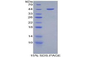 SDS-PAGE (SDS) image for Glial Fibrillary Acidic Protein (GFAP) (AA 108-211) protein (His tag,GST tag) (ABIN1879312) (GFAP Protein (AA 108-211) (His tag,GST tag))