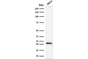 Western Blot Analysis of human HeLa cell lysate using p21 Mouse Monoclonal Antibody (DCS-60. (p21 antibody)