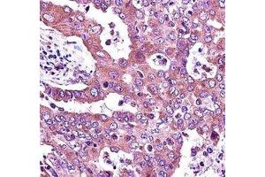 Immunohistochemistry (IHC) image for anti-Janus Kinase 2 (JAK2) (AA 666-694) antibody (ABIN3031509)