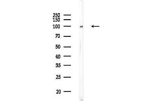 Western blot analysis of lysates from COLO205 cells, using alpha-Actinin Antibody at 1/1000 dilution.