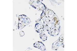 Immunohistochemistry of paraffin-embedded mouse kidney using PTEN Rabbit pAb  at dilution of 1:100 (40x lens). (PTEN antibody  (AA 209-403))