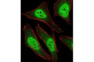 Fluorescent ige of Hela cells stained with D2L2 Antibody (C-term) (ABIN6243877 and ABIN6577436).