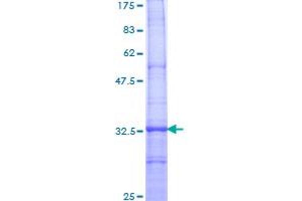 TRPC1 Protein (AA 442-505) (GST tag)