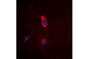 Immunofluorescent analysis of mGLUR4 staining in HeLa cells. (Metabotropic Glutamate Receptor 4 antibody  (C-Term))