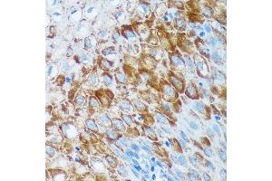 Immunohistochemistry of paraffin-embedded Human esophageal using IER5 Rabbit pAb (ABIN7267843) at dilution of 1:100 (40x lens).