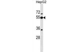 Western Blotting (WB) image for anti-Peptidase Inhibitor 16 (PI16) antibody (ABIN2999664) (PI16 antibody)