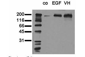 Phosphospecificity: Whole cell extracts of control (co), EGF stimulated (EGF) or pervanadate treated (VH) A549 tumor cells were applied to SDS-PAGE (20,000 cells per lane) and transferred to a PVDF membrane. (EGFR antibody  (pTyr1173))