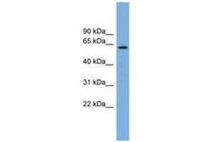 Image no. 1 for anti-Cytochrome P450, Family 26, Subfamily B, Polypeptide 1 (CYP26B1) (AA 35-84) antibody (ABIN6744175) (CYP26B1 antibody  (AA 35-84))