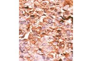 Image no. 1 for anti-Histone H3.1 (HIST1H3B) (pSer10) antibody (ABIN358137)