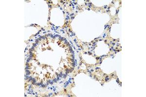 Immunohistochemistry of paraffin-embedded rat lung using LRG1 antibody. (LRG1 antibody)