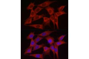 Immunofluorescence (IF) image for anti-Inositol Polyphosphate-5-Phosphatase K (INPP5K) (AA 149-448) antibody (ABIN6142473)
