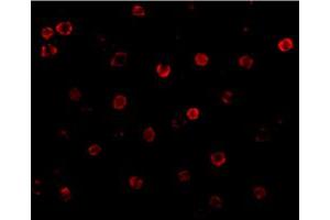 Immunofluorescence of CDH13 in K-562 cells with CDH13 polyclonal antibody  at 20 ug/mL . (Cadherin 13 antibody  (N-Term))