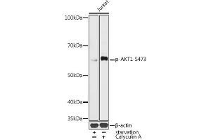 Western blot analysis of extracts of Jurka cells, using Phospho--S473 antibody (ABIN3019619, ABIN3019620, ABIN3019621 and ABIN1681366) at 1:1000 dilution. (AKT1 antibody  (pSer473))
