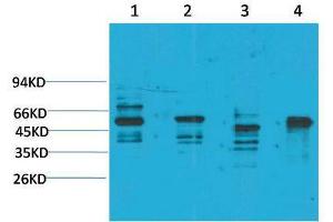 Western Blot (WB) analysis of 1) Rat Brain Tissue, 2)Mouse Brain Tissue, 3) K562, 4) HepG2 with KCNN4(SK4) Rabbit Polyclonal Antibody diluted at 1:2000. (KCNN4 antibody)