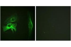 Immunofluorescence analysis of HeLa cells, using PAK1 (Ab-212) Antibody.