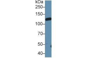 Western Blot; Sample: Rat Serum; Primary Ab: 1µg/ml Rabbit Anti-Rat LIFR Antibody Second Ab: 0. (LIFR antibody  (AA 152-291))