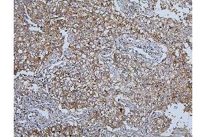 IHC analysis of HSPH1 using anti-HSPH1 antibody (ABIN7602237).