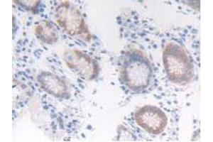 IHC-P analysis of Human Stomach Tissue, with DAB staining. (FGFRL1 antibody  (AA 168-378))
