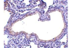 Image no. 2 for anti-Secretory Leukocyte Peptidase Inhibitor (SLPI) (Middle Region) antibody (ABIN318889) (SLPI antibody  (Middle Region))