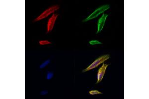 ABIN6262292 and ABIN6276762 staining Hela cells by IF/ICC.