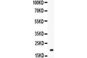 Anti- MGMT Picoband antibody, Western blotting All lanes: Anti MGMT  at 0. (MGMT antibody  (AA 2-207))