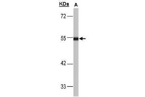 WB Image Sample(30 μg of whole cell lysate) A:293T 10% SDS PAGE antibody diluted at 1:1000 (DLD antibody)