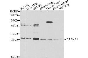 Western blot analysis of extracts of various cell lines, using CAPNS1 Antibody. (Calpain S1 antibody  (AA 69-268))
