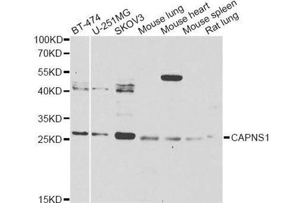 Calpain S1 antibody  (AA 69-268)