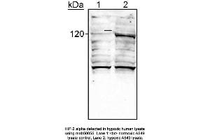 Image no. 1 for anti-Endothelial PAS Domain Protein 1 (EPAS1) (AA 535-631) antibody (ABIN363209) (EPAS1 antibody  (AA 535-631))