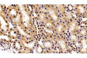 Immunohistochemistry (IHC) image for anti-Transketolase (TKT) (AA 1-294) antibody (ABIN7436402)