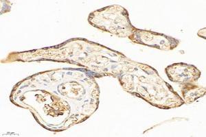 Immunohistochemistry analysis of paraffin-embedded humanplacentausing,ME2 (ABIN7074757) at dilution of 1:6000 (NAD-ME antibody)