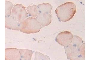 Detection of PFKP in Rat Skeletal muscle Tissue using Polyclonal Antibody to Phosphofructokinase, Platelet (PFKP) (PFKP antibody  (AA 354-570))