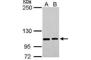 WB Image EPB41L3 antibody [C3], C-term detects EPB41L3 protein by Western blot analysis. (EPB41L3 antibody  (C-Term))