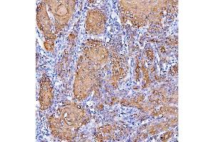 IHC analysis of Cytokeratin 1/KRT1 using anti-Cytokeratin 1/KRT1 antibody (ABIN7600651).
